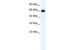 WB Suggested Anti-KCNH5 Antibody Titration:  0. (KCNH5 抗体  (N-Term))