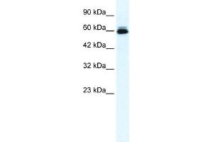 Western Blotting (WB) image for anti-Potassium Voltage-Gated Channel, Subfamily H (Eag-Related), Member 5 (KCNH5) (N-Term) antibody (ABIN2776313)