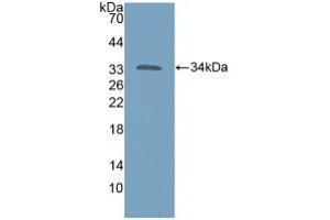 Figure. (KATNA1 抗体  (AA 8-229))