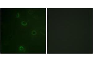 Immunofluorescence analysis of COS7 cells, using ATPase (Ab-16) Antibody. (ATPase 抗体  (AA 5-54))