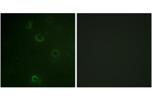 Immunofluorescence analysis of COS7 cells, using ATPase (Ab-16) Antibody.