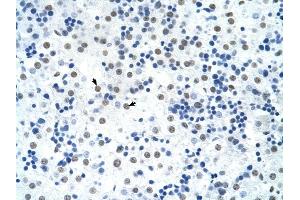 Immunohistochemistry (IHC) image for anti-Sterol Regulatory Element Binding Transcription Factor 1 (SREBF1) (Middle Region) antibody (ABIN926950)