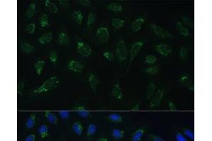 Immunofluorescence analysis of U-2 OS cells using HIGD1A Polyclonal Antibody at dilution of 1:100 (40x lens). (HIGD1A 抗体)