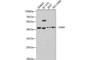 Western blot analysis of extracts of various cell lines using GJA4 Polyclonal Antibody at dilution of 1:1000. (GJA4 抗体)