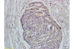 Immunohistochemistry (IHC) image for anti-G Protein-Coupled Estrogen Receptor 1 (GPER) (AA 251-375) antibody (ABIN685717)