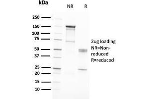 SDS-PAGE (SDS) image for anti-DNA Repair Protein Homolog 1 (RAD51) (AA 1-134) antibody (ABIN6940475)