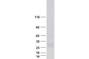 Western Blotting (WB) image for Epithelial Membrane Protein 3 (EMP3) protein (Myc-DYKDDDDK Tag) (ABIN2720161)
