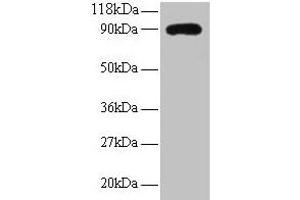 Western blot All lanes: RPL38 antibody at 2 μg/mL + EC109 whole cell lysate Secondary Goat polyclonal to rabbit IgG at 1/15000 dilution Predicted band size: 90 kDa Observed band size: 90 kDa (RPL38 抗体  (AA 1-70))