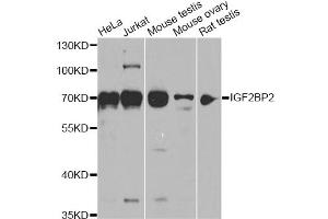 Western blot analysis of extracts of various cell lines, using IGF2BP2 antibody (ABIN6293018) at 1:1000 dilution. (IGF2BP2 抗体)