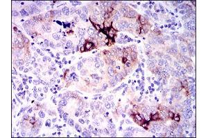 Image no. 4 for anti-Secreted phosphoprotein 1 (SPP1) antibody (ABIN1491004)
