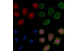 DERA Antibody staining Hela cells(45 min of heat-shock treatment) by IF/ICC.