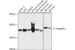 Western blot analysis of extracts of various cell lines, using PNLIPRP1 antibody (ABIN7269167) at 1:1000 dilution.