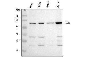 Western blot analysis of BRD2 using anti-BRD2 antibody (ABIN7599091).