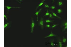 Immunofluorescence of purified MaxPab antibody to TUBG1 on HeLa cell. (TUBG1 抗体  (AA 1-451))