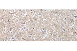 Immunohistochemistry of paraffin-embedded Human brain tissue using GZMM Polyclonal Antibody at dilution of 1:25(x200) (GZMM 抗体)