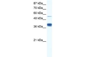 WB Suggested Anti-DKFZP781I1119 Antibody Titration:  0. (DKFZP781I1119 (N-Term) 抗体)