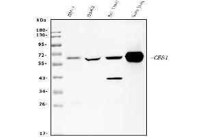 Western blot analysis of Liver Carboxylesterase 1/CES1 using anti-Liver Carboxylesterase 1/CES1 antibody (ABIN7602719).