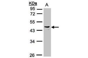 WB Image Sample(30 ug whole cell lysate) A:Raji , 10% SDS PAGE antibody diluted at 1:1000 (PSG6 抗体)