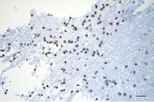 Immunohistochemistry was performed on paraffin-embedded mouse brain using XPD antibody (ABIN7798540), 1:200). (Recombinant ERCC2 抗体)