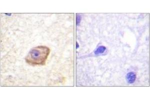 Immunohistochemistry analysis of paraffin-embedded human brain, using NMDAR2B (Phospho-Tyr1474) Antibody. (GRIN2B 抗体  (pTyr1474))