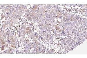 Immunohistochemistry (IHC) image for anti-Olfactory Receptor, Family 52, Subfamily J, Member 3 (OR52J3) (N-Term) antibody (ABIN6263875)