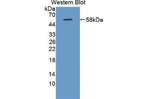 Western blot analysis of recombinant Rat RAGE. (MOK 抗体  (AA 1-237))