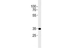 Western Blotting (WB) image for anti-Cannabinoid Receptor 2 (CNR2) (AA 329-356) antibody (ABIN3030275)