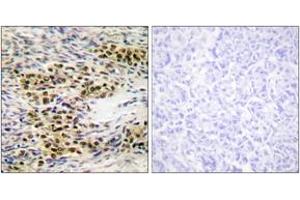 Immunohistochemistry analysis of paraffin-embedded human ovary tissue, using Akt (Ab-246) Antibody. (AKT1 抗体  (AA 212-261))