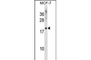 CMTM5 Antibody (Center) (ABIN1538533 and ABIN2849118) western blot analysis in MCF-7 cell line lysates (35 μg/lane). (CMTM5 抗体  (AA 62-88))
