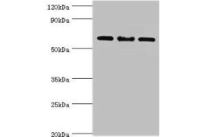 Western blot All lanes: IL22RA1 antibody at 10 μg/mL Lane 1: Mouse spleen tissue Lane 2: HepG2 whole cell lysate Lane 3: 293T whole cell lysate Secondary Goat polyclonal to rabbit IgG at 1/10000 dilution Predicted band size: 63 kDa Observed band size: 63 kDa (IL22 Receptor alpha 1 抗体  (AA 16-230))