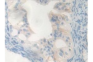 Immunohistochemistry (IHC) image for anti-Carboxypeptidase B1 (Tissue) (CPB1) (AA 109-415) antibody (ABIN7441850)