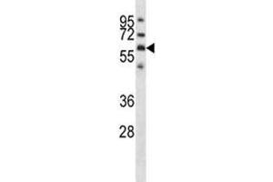 GPC3 antibody western blot analysis in NCI-H292 lysate.