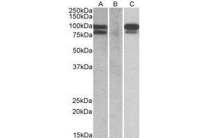 Western Blotting (WB) image for anti-Proprotein Convertase Subtilisin/kexin Type 9 (PCSK9) (Internal Region) antibody (ABIN2464566) (PCSK9 抗体  (Internal Region))