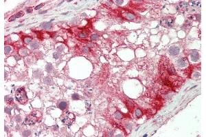 Rabbit Anti-KLHL25 antibody  Formalin Fixed Paraffin Embedded Tissue: Human Testis Primary antibody Concentration: 1:100 Secondary Antibody: Donkey anti-Rabbit-Cy3 Secondary Antibody Concentration: 1:200 Magnification: 20x Exposure Time: 0. (KLHL25 抗体  (N-Term))