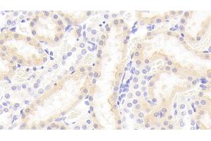 Immunohistochemistry (IHC) image for anti-Von Willebrand Factor A Domain Containing 1 (VWA1) (AA 43-285) antibody (ABIN7440287)