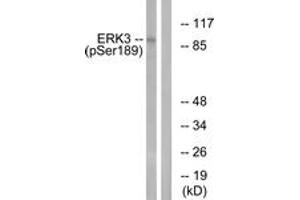 Western blot analysis of extracts from mouse brain, using ERK3 (Phospho-Ser189) Antibody. (MAPK6 抗体  (pSer189))
