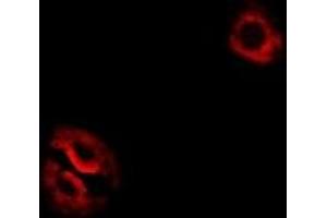 Immunofluorescent analysis of RPL14 staining in Hela cells.
