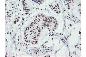 Image no. 1 for anti-SUMO1/sentrin/SMT3 Specific Peptidase 2 (SENP2) (AA 139-523) antibody (ABIN1490925) (SENP2 抗体  (AA 139-523))