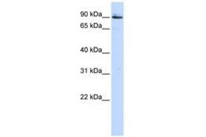 Image no. 1 for anti-Proprotein Convertase Subtilisin/kexin Type 5 (PCSK5) (AA 792-841) antibody (ABIN6743186) (PCSK5 抗体  (AA 792-841))