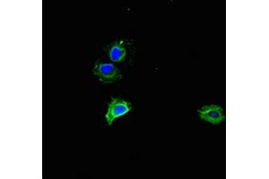 Immunofluorescent analysis of Hela cells using ABIN7142866 at dilution of 1:100 and Alexa Fluor 488-congugated AffiniPure Goat Anti-Rabbit IgG(H+L) (MMP2 抗体  (AA 445-660))