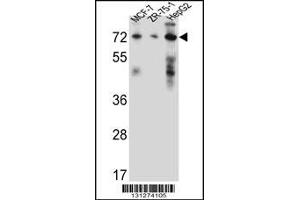 Western blot analysis in MCF-7,ZR-75-1,HepG2 cell line lysates (35ug/lane). (HSD17B4 抗体  (AA 341-370))