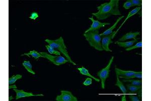 Immunofluorescence of monoclonal antibody to ALS2 on HeLa cell. (ALS2 抗体  (AA 221-320))