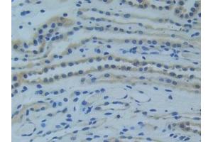 Detection of TNFR1 in Human Kidney Tissue using Polyclonal Antibody to Tumor Necrosis Factor Receptor 1 (TNFR1)