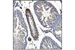 IHC analysis of TAGLN/Transgelin using anti-TAGLN/Transgelin antibody (ABIN7600099). (Transgelin 抗体  (AA 15-170))