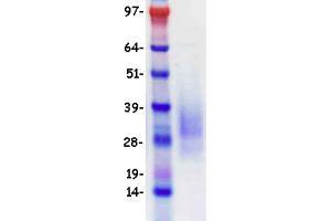 Western Blotting (WB) image for B-cell antigen receptor complex-associated protein alpha chain (CD79A) (Transcript Variant 1) protein (DYKDDDDK-His Tag) (ABIN2713776)