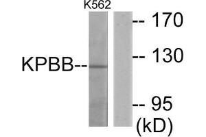 Western blot analysis of extracts from K562 cells, using KPBB antibody. (PHKB 抗体  (Internal Region))
