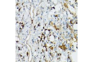 Immunohistochemistry of paraffin-embedded rat lung using TLR1 Rabbit pAb (ABIN3023654, ABIN3023655, ABIN3023656 and ABIN6214092) at dilution of 1:100 (40x lens). (TLR1 抗体  (AA 30-290))