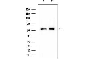 Western blot analysis of lysates from various samples, using P4HB Mouse Monoclonal Antibody at 1/1000 dilution.