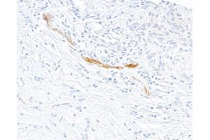 Immunohistochemistry (IHC) image for anti-Selectin E (SELE) (AA 22-555) antibody (ABIN7795699) (Recombinant Selectin E/CD62e 抗体  (AA 22-555))
