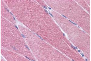 Human Skeletal Muscle: Formalin-Fixed, Paraffin-Embedded (FFPE) (CREB3L1 抗体  (AA 497-509))